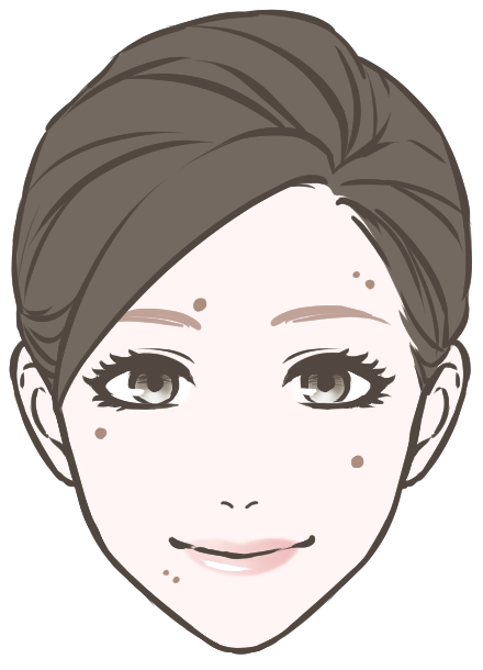 ほくろ・イボを取りたい