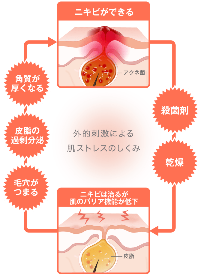 外的刺激による肌ストレスのしくみ