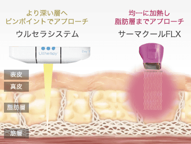 ウルセラシステムとサーマクールFLX照射イメージ比較