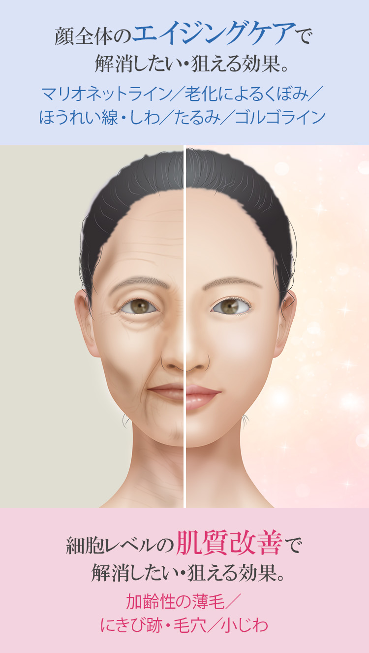 年齢を重ねるにつれ深まる悩み/幹細胞注入/点滴治療で期待できる効果