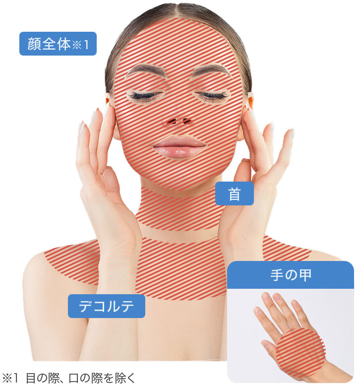 肌育注射施術可能部位※1 目の際、口の際を除く