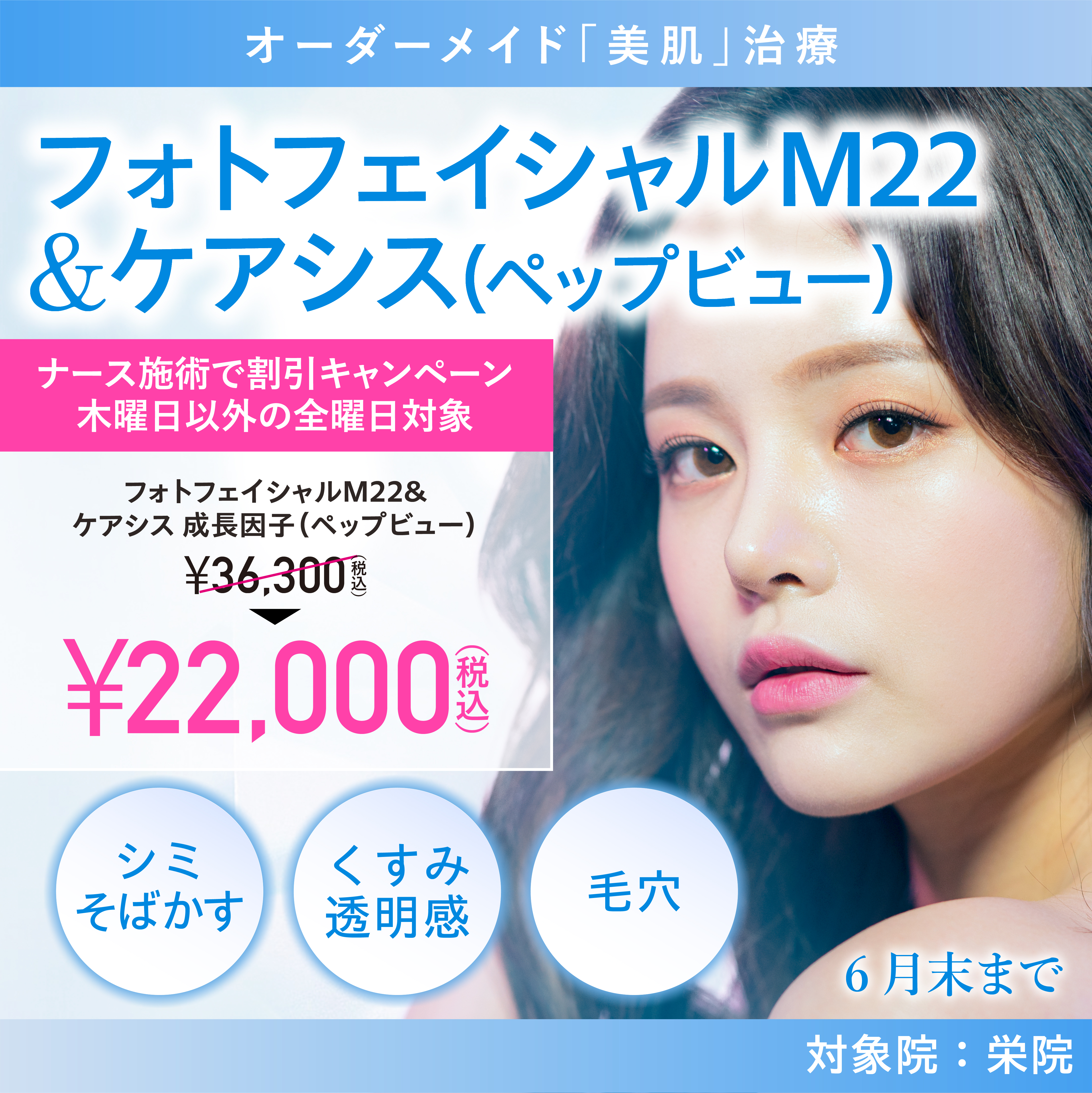 フォトフェイシャルM22&ケアシス 成長因子(ペップビュー)キャンペーン/ナース施術 22,000円(税込)/栄院限定 木曜日以外の全曜日対象/6月末まで