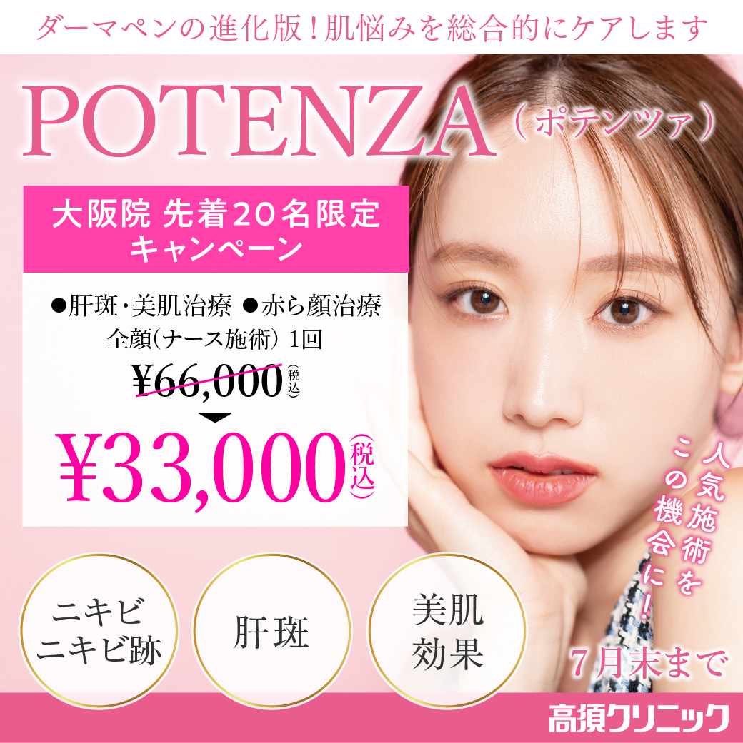 ポテンツァ/肝斑・美肌治療、赤ら顔治療 全顔ナース施術1回 ¥33,000(税込)(先着20名限定)/大阪院限定/7月末まで