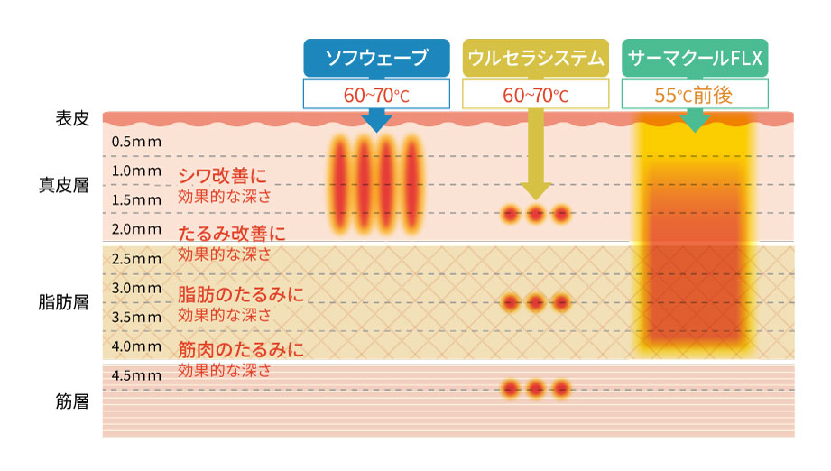 照射エリア、効果のあるお肌の層の比較表