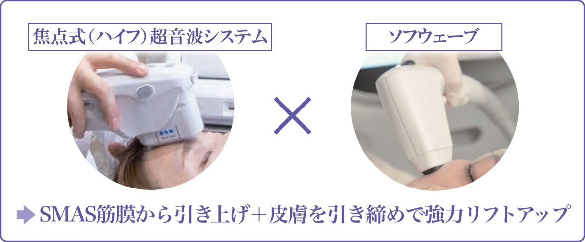 焦点式（ハイフ）超音波システム×ソフウェーブ SMAS沿層から引き上げ＋皮膚を引き締めで強力リフトアップ