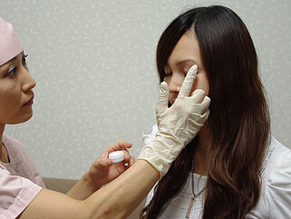 麻酔クリームを塗る様子