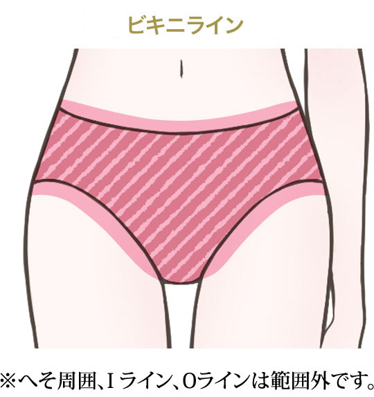 ビキニライン※へそ周囲、Iライン、Oラインは範囲外です。