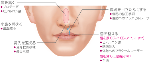 鼻を高く 小鼻を整える 鼻先を整える 傷跡を目立たなくする 唇を整える(唇を厚く(ふっくら・アヒル口etc)/唇を薄く(口唇縮小術))