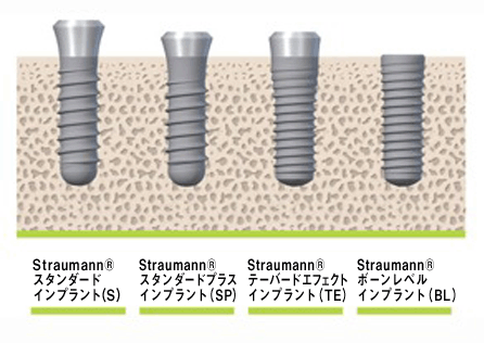 Straumann スタンダードインプラント(S) Straumann スタンダードプラスインプラント(SP) Straumann テーバードエフェクトインプラント(TE) Straumann ボーンレベルインプラント(BL)