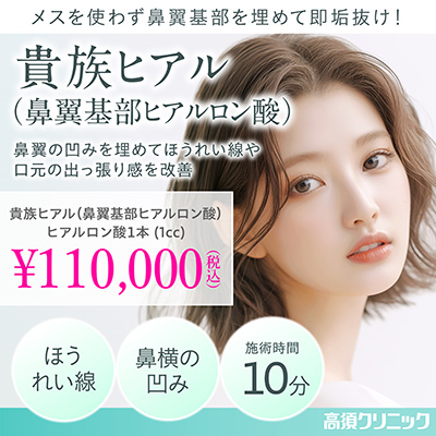 メスを使わず鼻翼基部を埋めて即垢抜け！/貴族ヒアル（鼻翼基部ヒアルロン酸）