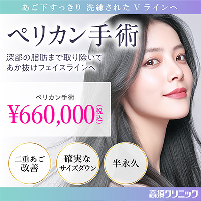 あご下すっきり 洗練されたVラインへ/ペリカン手術