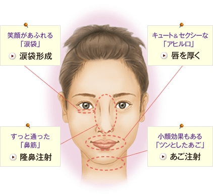 笑顔があふれる「涙袋」 涙袋形成 キュート&セクシーな「アヒル口」 唇を厚く すっと通った「鼻筋」 隆鼻注射 小顔効果もある「ツンとしたあご」 あご注射